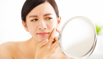 best-way-to-get-rid-of-acne-scars