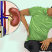 Kidney Stones Removal